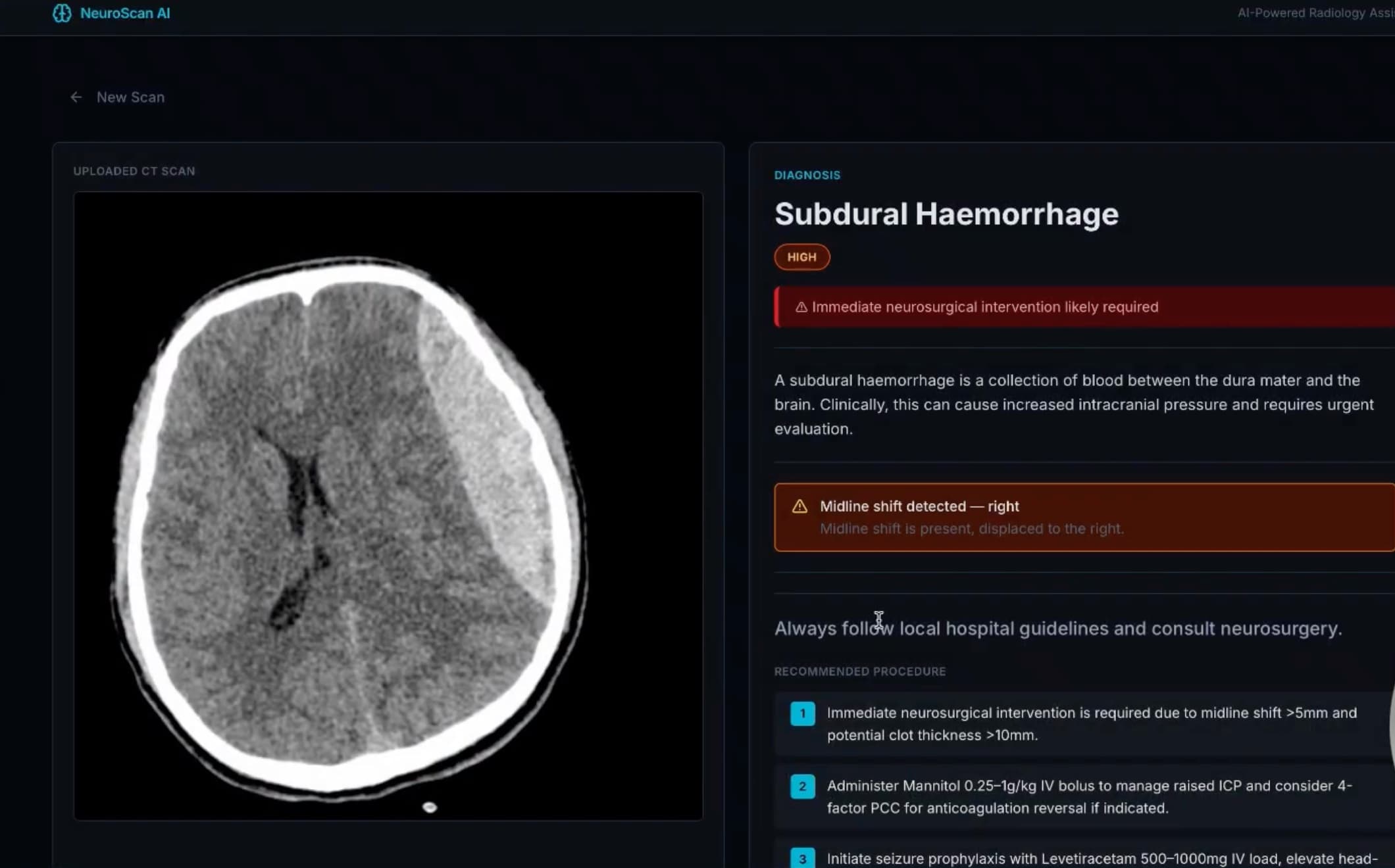 NeuroScan AI screenshot 1